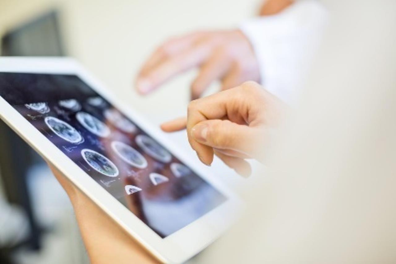 Tablet with photos of brain scans with a hand hovering over the screen